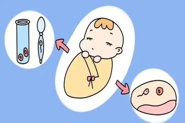 自助赴日本做试管婴儿你需要提前了解这些内容
