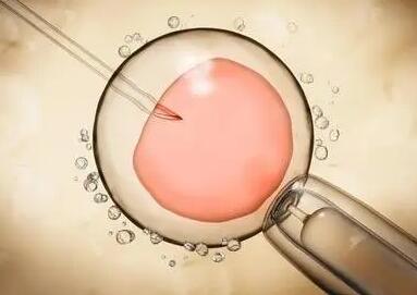 试管移植鲜胚也能怀双胎，分裂成双胞胎的几率值得了解