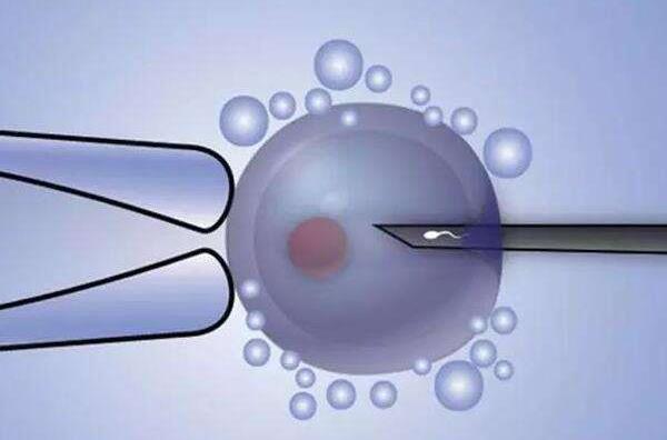 三代试管婴儿筛查囊胚送检有标准胚胎数量就是其中之一