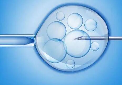 囊胚级别4bc和5bc是什么，什么样的不孕患者适合进行囊胚培养