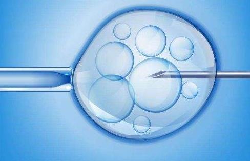 美国供精试管可否双胞胎美国试管婴儿双胞胎靠谱吗